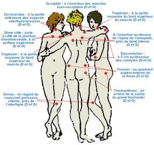 fibromyalgie, maladie mystérieuse et mal connue