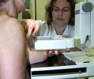 mammographie mammographie