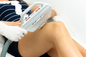 épilation définitive par laser épilation définitive par laser