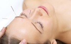 Maigrir par l’acupuncture