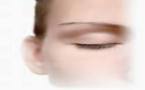 Beauté : technique sans chirurgie