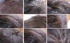 Premiers cheveux blancs : les premiers gestes